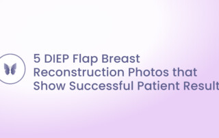 5 DIEP Flap Patient Photos