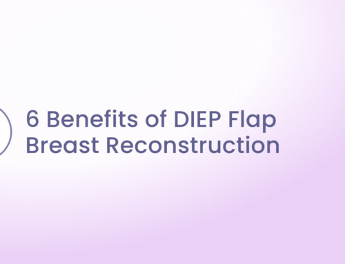 The 6 Benefits of DIEP Flap Breast Reconstruction