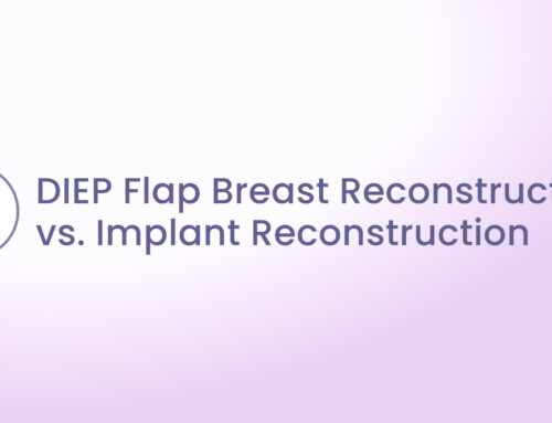 DIEP Flap Breast Reconstruction vs. Implant Reconstruction