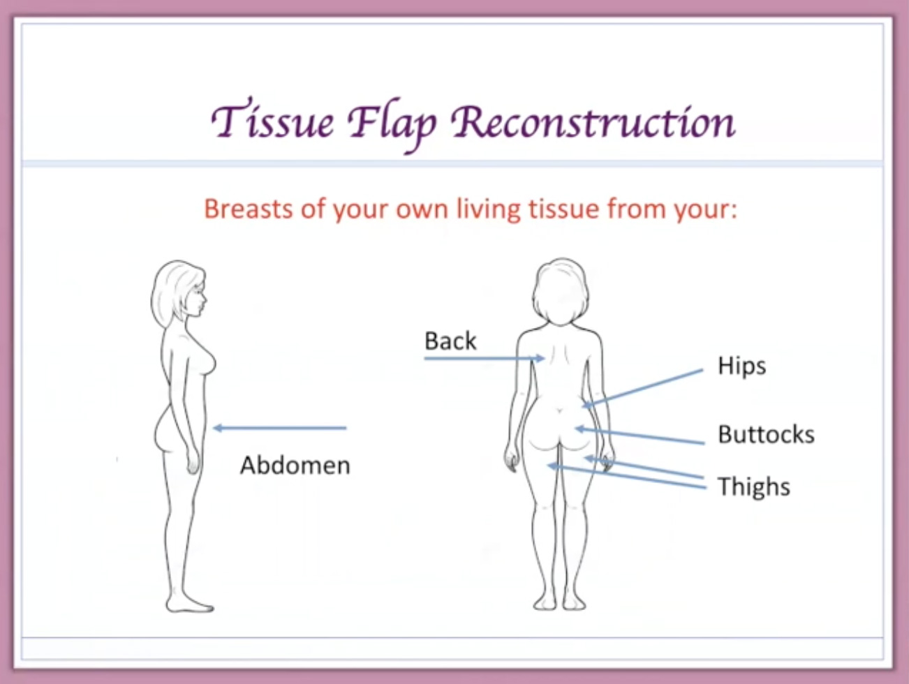 Choosing To Go Flat Instead of Breast Reconstruction - OWise UK