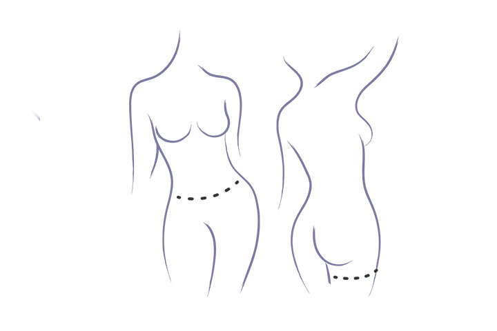 Sagging Breast Shape Is Isosceles Triangle Connecting Three Points From  Center Of Clavicle To Top Boobs. Beauty And Body Care Concept Illustration  Royalty Free SVG, Cliparts, Vectors, and Stock Illustration. Image  157088138.