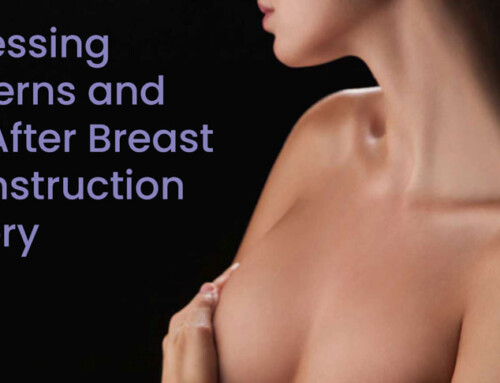 Addressing Concerns and Pain After Breast Reconstruction Surgery