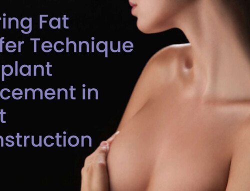 Exploring Fat Transfer Technique for Implant Replacement in Breast Reconstruction