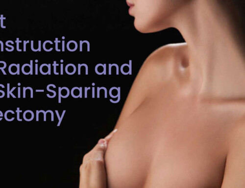 Breast Reconstruction After Radiation and Non-Skin-Sparing Mastectomy