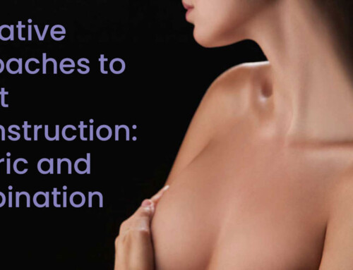 Innovative Approaches to Complex Breast Reconstruction Cases: Esoteric and Combination Flaps