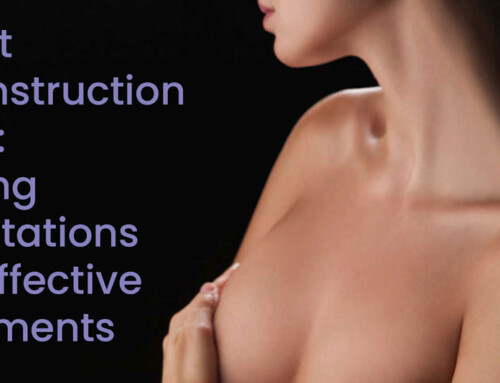 Breast Reconstruction Scars: Healing Expectations and Effective Treatments